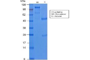 SDS-PAGE Analysis of Purified Cytokeratin 8 Rabbit Recombinant Monoclonal Antibody (KRT8/2174R). (Recombinant KRT8 antibody)