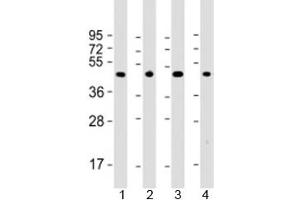 Western blot testing of 1) mouse brain, 2) human A431, 3) rat PC-12 and 4) human U-87 MG cell lysate with Thyroid hormone receptor alpha antibody at 1:2000. (THRA antibody  (AA 107-139))