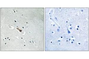 Immunohistochemistry analysis of paraffin-embedded human brain, using APLP2 (Phospho-Tyr755) Antibody. (APLP2 antibody  (pTyr755))
