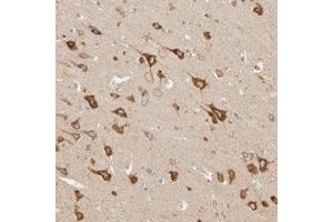 Immunohistochemical staining of human lateral ventricle wall with sERPINI1 polyclonal antibody  shows strong cytoplasmic positivity in neuronal cells. (Neuroserpin antibody)