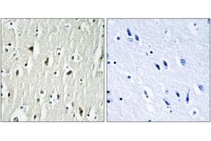 Immunohistochemistry analysis of paraffin-embedded human brain tissue, using CSK (Ab-364) Antibody. (CSK antibody  (AA 330-379))