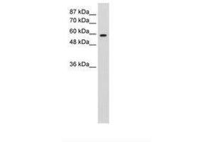 Image no. 2 for anti-Deleted in Azoospermia 2 (DAZ2) (AA 51-100) antibody (ABIN6736260)