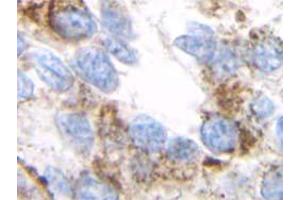Immunohistochemistry (IHC) image for anti-Transforming Growth Factor, beta 1 (TGFB1) antibody (ABIN181152) (TGFB1 antibody)