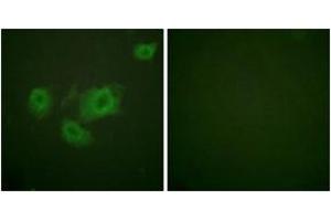 Immunofluorescence analysis of HuvEc cells, using Kir6. (KCNJ11 antibody  (pThr224))