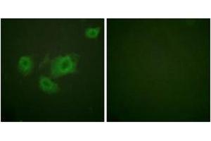 Immunofluorescence analysis of HuvEc cells, using Kir6. (KCNJ11 antibody  (pThr224))