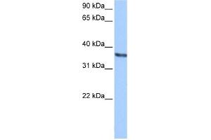 Chondroadherin antibody used at 0. (CHAD antibody  (Middle Region))