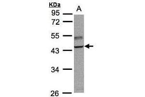 WB Image Sample(30 ug whole cell lysate) A:Raji , 10% SDS PAGE antibody diluted at 1:3000 (TRAF1 antibody)