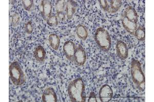 Immunostaining (ISt) image for anti-Eukaryotic Translation Initiation Factor 4E Family Member 2 (EIF4E2) (AA 1-245) antibody (ABIN564092)