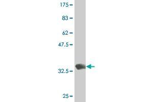 Western Blot detection against Immunogen (34. (DLX1 antibody  (AA 181-254))
