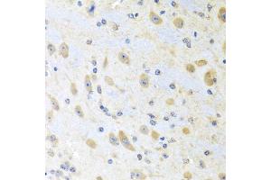 Immunohistochemistry of paraffin-embedded mouse brain using MLN antibody. (Motilin antibody)