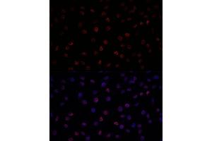 Immunofluorescence (IF) image for anti-Splicing Factor 3b, Subunit 1, 155kDa (SF3B1) (AA 1-144) antibody (ABIN7270543)
