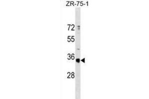 Western Blotting (WB) image for anti-Olfactory Receptor, Family 51, Subfamily G, Member 1 (OR51G1) antibody (ABIN3000138) (OR51G1 antibody)