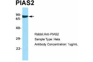 Host:  Rabbit  Target Name:  PIAS2  Sample Type:  Hela  Antibody Dilution:  1. (PIAS2 antibody  (C-Term))