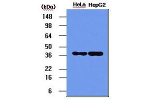 Western blot analysis: The HeLa and HepG2 cell lysates (5ug) were resolved by SDS-PAGE, transferred to PVDF membrane and probed with anti-human NPM (1:1000). (NPM1 antibody)