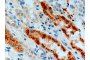 ABIN185477 (3µg/ml) staining of paraffin embedded Human Kidney. (Adenosine A2b Receptor antibody  (C-Term))