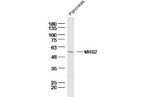 Mouse pancreas lysates probed with MRS2 Polyclonal Antibody, Unconjugated  at 1:300 dilution and 4˚C overnight incubation.