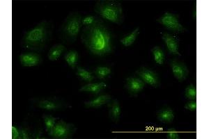 Immunofluorescence (IF) image for anti-Hepatocyte Growth Factor-Regulated tyrosine Kinase Substrate (HGS) (AA 513-612) antibody (ABIN563958)