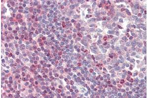 Human Tonsil (formalin-fixed, paraffin-embedded) stained with ZAP70 antibody ABIN461961 at 20 ug/ml followed by biotinylated anti-mouse IgG secondary antibody ABIN481714, alkaline phosphatase-streptavidin and chromogen. (ZAP70 antibody)