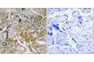 Immunohistochemistry analysis of paraffin-embedded human placenta, using PAK1 (Phospho-Ser199) Antibody.