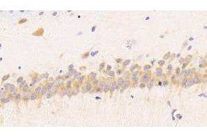 Detection of RETN in Rat Cerebrum Tissue using Polyclonal Antibody to Resistin (RETN) (Resistin antibody  (AA 45-114))