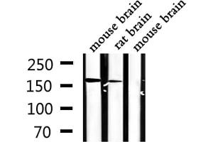 Western blot analysis of extracts from mouse brain,rat brain, using STK36 Antibody. (STK36 antibody  (Internal Region))