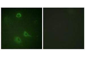 Immunofluorescence analysis of A549 cells, using NMDAR1 (Phospho-Ser890) antibody. (GRIN1/NMDAR1 antibody  (pSer890))