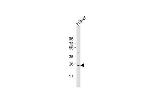 Anti-IGFBP-3- Antibody at 1:1000 dilution + human liver lysate Lysates/proteins at 20 μg per lane. (IGFBP3 antibody  (AA 162-189))
