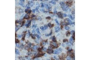 Immunohistochemical analysis of LCK staining in human lymph node formalin fixed paraffin embedded tissue section.