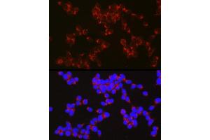 Immunofluorescence analysis of SH-SY5Y cells using  Rabbit pAb (ABIN6129958, ABIN6136993, ABIN6136994 and ABIN6222595) at dilution of 1:50 (40x lens).
