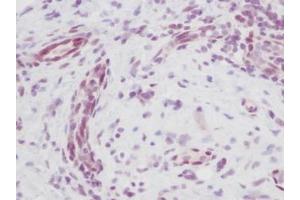 Image no. 5 for anti-Melanoma Inhibitory Activity (MIA) antibody (ABIN464852) (MIA antibody)