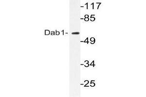 Western blot (WB) analyzes of Dab1 antibody in extracts from HeLa cells.