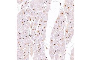 GTF3C2 antibody