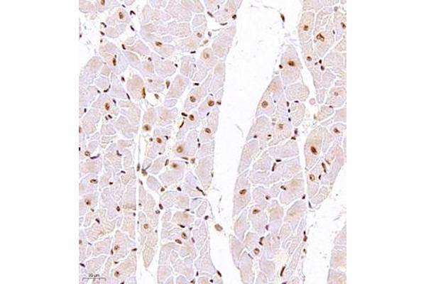 GTF3C2 antibody