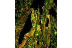 Immunofluorescence (IF) image for anti-Capping Protein (Actin Filament) Muscle Z-Line, alpha 1 (CAPZA1) antibody (ABIN3003245) (CAPZA1 antibody)