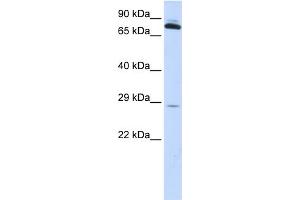 WB Suggested Anti-TPK1 Antibody Titration: 0. (TPK1 antibody  (N-Term))