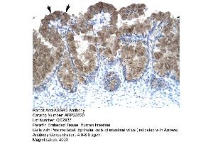 Human Intestine (Asialoglycoprotein Receptor 2 antibody  (N-Term))