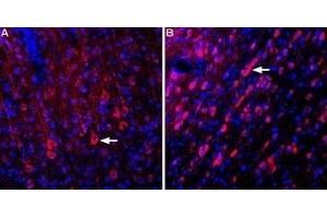 Expression of Glutamate receptor δ1 in rat cortex and medial septum - Immunohistochemical staining of perfusion-fixed frozen rat brain sections using Anti-GRID1 (extracellular) Antibody (ABIN7043235, ABIN7044374 and ABIN7044375), (1:400). (GRID1 antibody  (Extracellular, N-Term))
