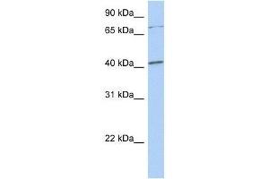 Western Blot showing SOX4 antibody used at a concentration of 1. (SOX4 antibody  (N-Term))