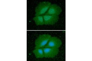ICC/IF analysis of Cyclophilin B in Hep3B cells line, stained with DAPI (Blue) for nucleus staining and monoclonal anti-human Cyclophilin B antibody (1:100) with goat anti-mouse IgG-Alexa fluor 488 conjugate (Green). (PPIB antibody  (AA 26-216))