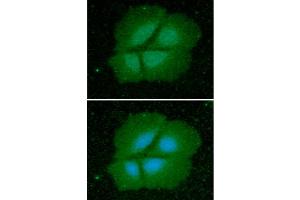 ICC/IF analysis of Cyclophilin B in Hep3B cells line, stained with DAPI (Blue) for nucleus staining and monoclonal anti-human Cyclophilin B antibody (1:100) with goat anti-mouse IgG-Alexa fluor 488 conjugate (Green). (PPIB antibody)