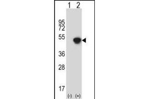 Western blot analysis of GCAT (arrow) using rabbit polyclonal GCAT Antibody (N-term) (ABIN656823 and ABIN2846034). (GCAT antibody  (N-Term))