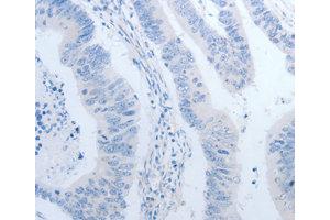 Immunohistochemistry (IHC) image for anti-Neurogenin 1 (NEUROG1) antibody (ABIN1873884) (Neurogenin 1 antibody)