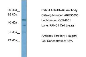 WB Suggested Anti-TINAG  Antibody Titration: 0. (TINAG antibody  (Middle Region))