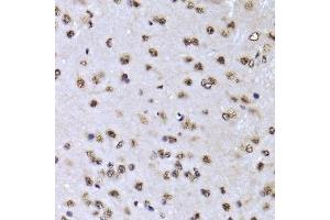 EFTUD2 antibody  (AA 1-205)