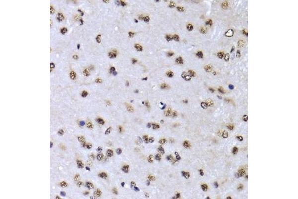 EFTUD2 antibody  (AA 1-205)