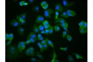 Immunofluorescence staining of MCF-7 cells with ABIN7171412 at 1:266, counter-stained with DAPI. (TCP1 alpha/CCTA antibody  (AA 406-506))