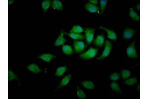 Immunofluorescence staining of A549 cells with ABIN7167130 at 1:100, counter-stained with DAPI. (RASSF3 antibody  (AA 2-109))