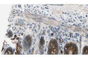ABIN6274510 at 1/100 staining Mouse intestine tissue by IHC-P. (Sema4a antibody  (Internal Region))