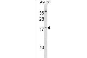 Western Blotting (WB) image for anti-Nescient Helix Loop Helix 2 (NHLH2) antibody (ABIN2998885) (NHLH2 antibody)