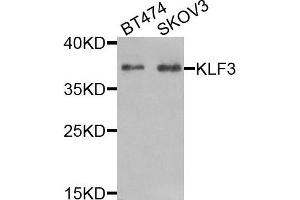 Western blot analysis of extracts of BT474 and SKOV3 cells, using KLF3 antibody. (KLF3 antibody)